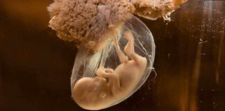 Billionaire Baby Factory EXPOSED! A translucent jellyfish embryo suspended in a fluid-filled sac